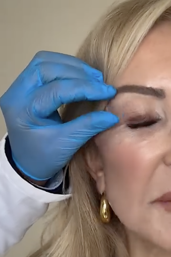 Carmen Lomana a subi une blépharoplastie avec les Clínicas Diego de León.